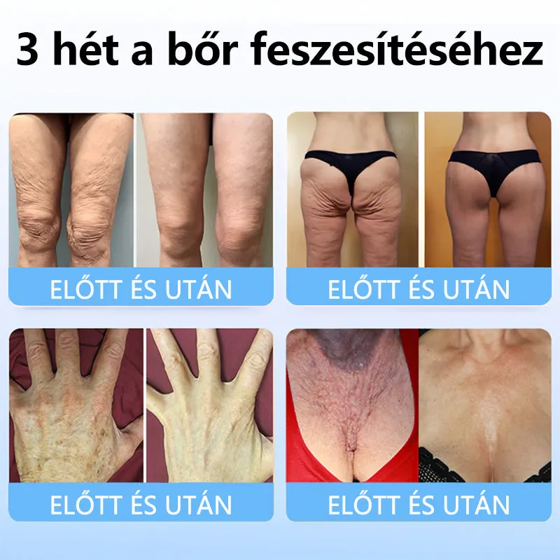 Bara de esență de îmbunătățire a peptidelor de colagen